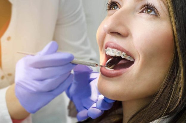 how to care for braces teenager learning how to care for braces