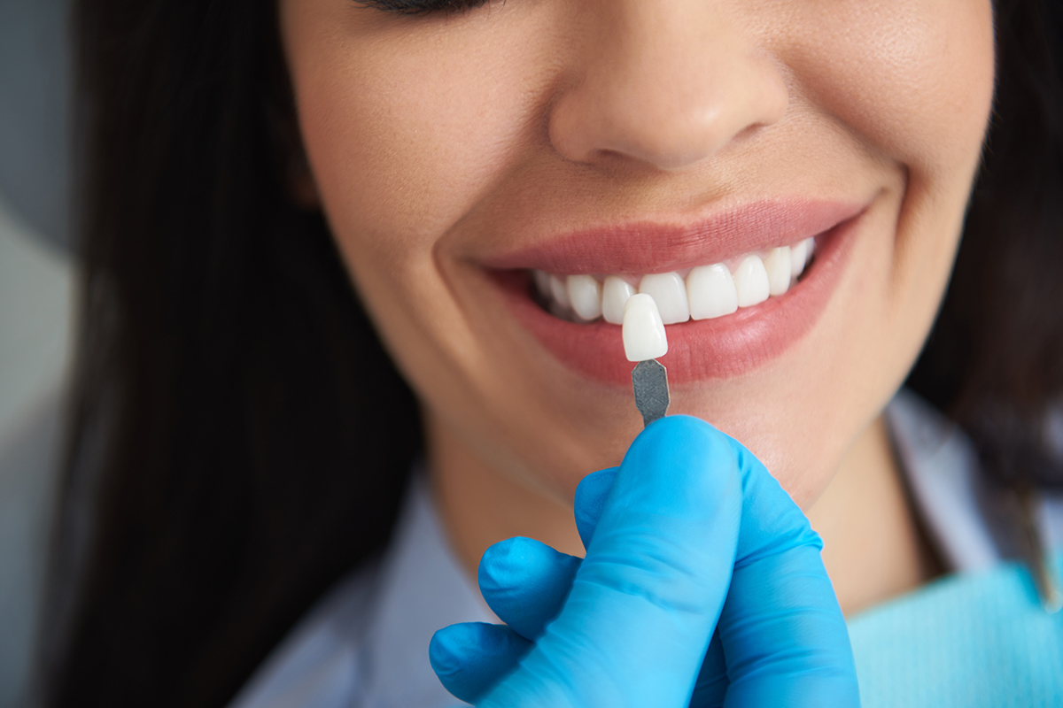 teeth whitening options (2) women exploring teeth whitening options