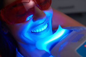 a person undergoes teeth whitening services